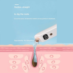 Alternative view of QIAOYANG συσκευή καθαρισμού προσώπου QA-T663 – QIAOYANG face cleaning device QA-T663