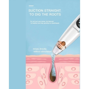 Alternative view of QIAOYANG συσκευή καθαρισμού προσώπου QA-T664 – Qiaoyang face cleaning device QA-T664